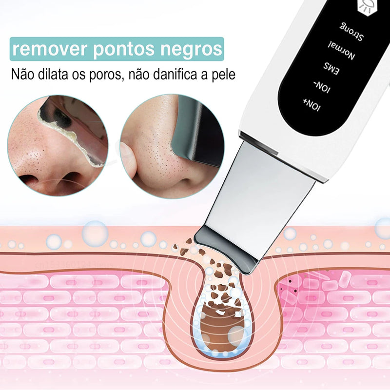 Removedor de Cravos e Limpeza de Pele Ultrassonic