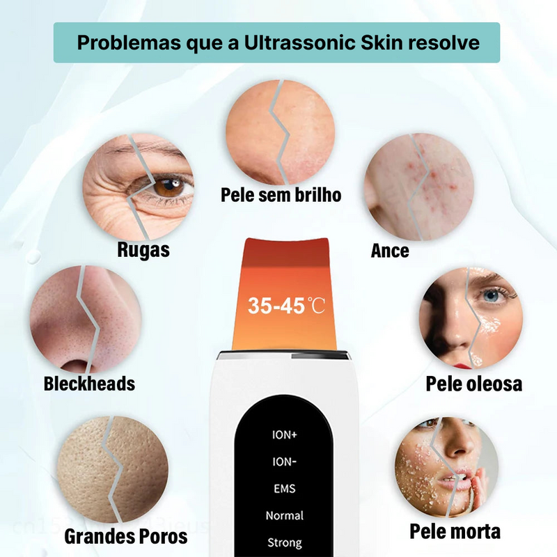 Removedor de Cravos e Limpeza de Pele Ultrassonic